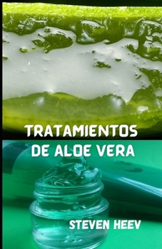 Tratamientos de aloe vera