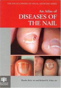 Hardcover An Atlas of Diseases of the Nail Book
