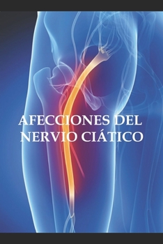 Paperback Afecciones del nervio ciático [Spanish] Book