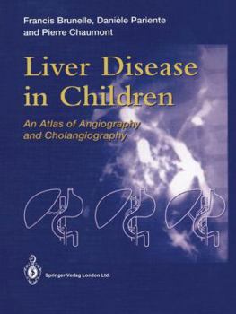 Paperback Liver Disease in Children: An Atlas of Angiography and Cholangiography Book