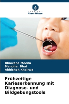 Frühzeitige Karieserkennung mit Diagnose- und Bildgebungstools (German Edition)