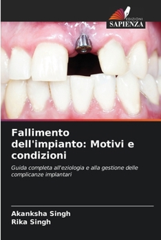 Paperback Fallimento dell'impianto: Motivi e condizioni [Italian] Book