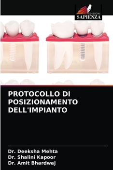 Paperback Protocollo Di Posizionamento Dell'impianto [Italian] Book