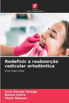 Redefinir a reabsorção radicular ortodôntica (Portuguese Edition)