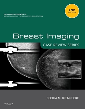 Paperback Breast Imaging: Case Review Series Book