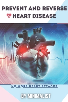 Paperback Preventing and Reversing Heart Disease: A Simple Guidebook To Keep Your Heart Healthy & To Lawer The Chance to Get a Heart Attack, Things To Do To Cha Book