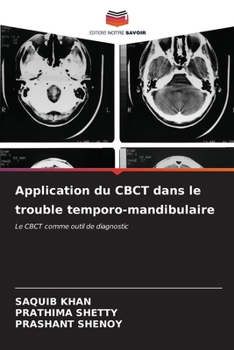 Paperback Application du CBCT dans le trouble temporo-mandibulaire [French] Book