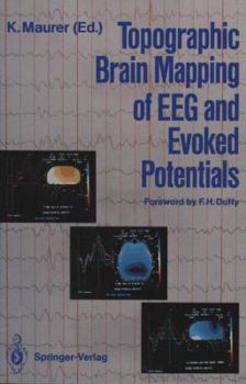Paperback Topographic Brain Mapping of Eeg and Evoked Potentials Book