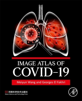 Paperback Image Atlas of Covid-19 Book