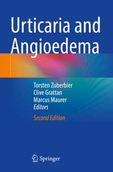 Paperback Urticaria and Angioedema Book