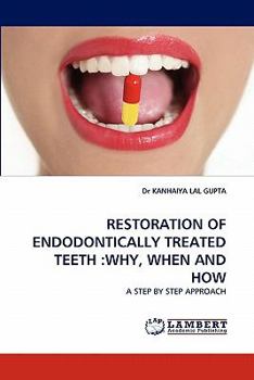 Restoration of Endodontically Treated Teeth: Why, When and How