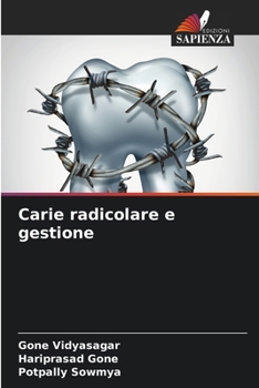 Paperback Carie radicolare e gestione [Italian] Book