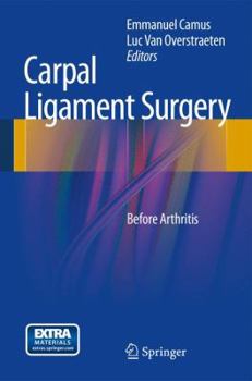 Hardcover Carpal Ligament Surgery: Before Arthritis Book