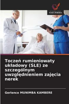 Toczen rumieniowaty ukladowy (SLE) ze szczególnym uwzglednieniem zajecia nerek (Polish Edition)