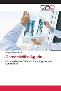 Paperback Osteomielitis Aguda [Spanish] Book