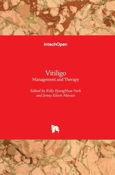 Hardcover Vitiligo: Management and Therapy Book