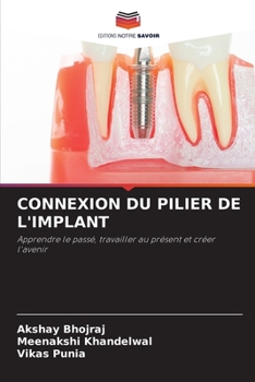 Paperback Connexion Du Pilier de l'Implant [French] Book