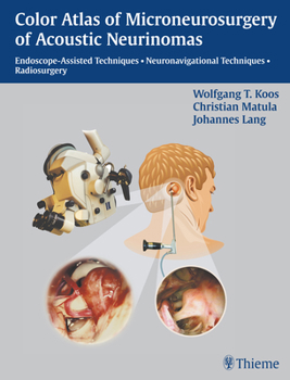 Hardcover Color Atlas of Microsurgery of Acoustic Neurinomas: Endoscope-Assisted Techniques - Neuronavigational Techniques - Radiosurgery Book