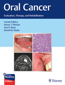 Hardcover Oral Cancer: Evaluation, Therapy, and Rehabilitation Book