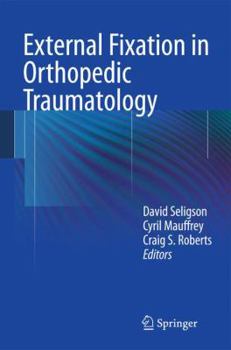 Hardcover External Fixation in Orthopedic Traumatology Book