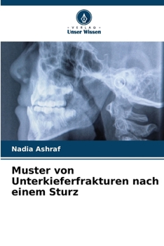 Paperback Muster von Unterkieferfrakturen nach einem Sturz [German] Book
