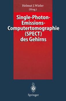 Paperback Single-Photon-Emissions-Computertomographie (Spect) Des Gehirns [German] Book