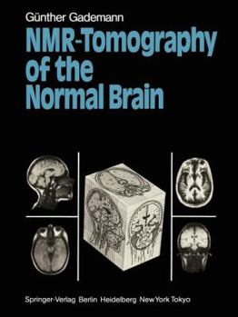 Paperback Nmr-Tomography of the Normal Brain Book