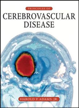 Paperback Principles of Cerebrovascular Disease Book