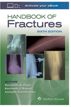 Paperback Handbook of Fractures Book