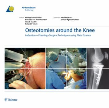 Plastic Comb Osteotomies Around the Knee: Indications - Planning - Surgical Techniques Using Plate Fixators Book