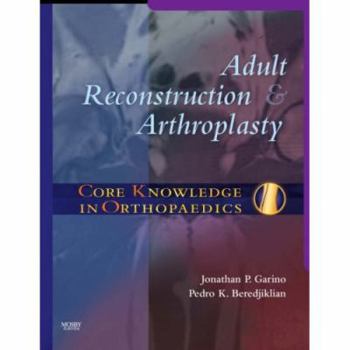 Hardcover Core Knowledge in Orthopaedics: Adult Reconstruction and Arthroplasty Book