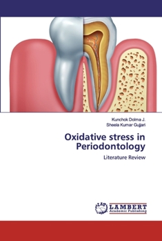 Paperback Oxidative stress in Periodontology Book