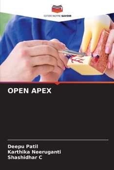 Paperback Open Apex [French] Book