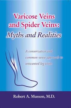 Paperback Varicose Veins and Spider Veins: Myths and Realities Book