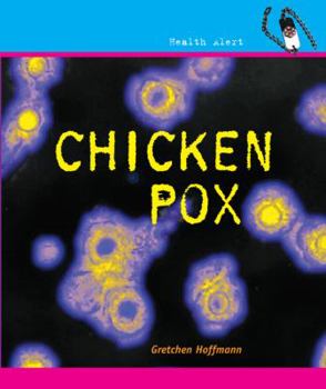 Chickenpox - Book  of the Health Alert