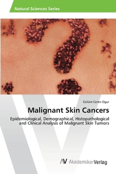 Paperback Malignant Skin Cancers Book