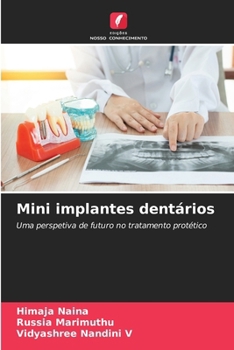 Paperback Mini implantes dentários [Portuguese] Book