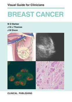 Hardcover Breast Cancer: Visual Guide for Clinicians Book