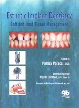 Hardcover Esthetic Implant Dentistry: Soft & Hard Tissue Book