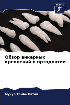 Paperback Обзор анкерных креплени& [Russian] Book