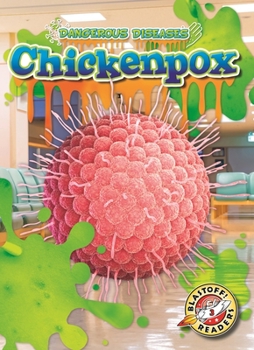Library Binding Chicken Pox Book