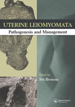 Hardcover Uterine Leiomyomas: Pathogenesis and Management Book