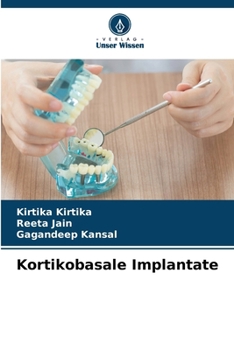 Paperback Kortikobasale Implantate [German] Book