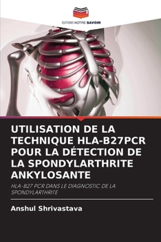 Paperback Utilisation de la Technique Hla-B27pcr Pour La Détection de la Spondylarthrite Ankylosante [French] Book