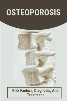 Paperback Osteoporosis: Risk Factors, Diagnosis, And Treatment: Factors That Affect Bone Health Book