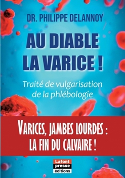 Paperback Au diable la varice !: Varices, jambes lourdes: la fin du calvaire ! [French] Book