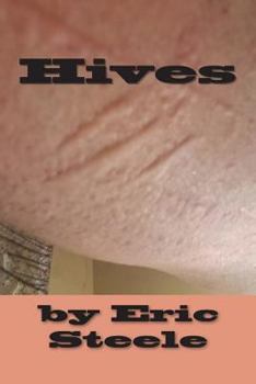 Paperback Hives Book