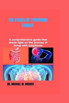 The Stages of Lymphoma Cancer: A comprehensive guide that sheds light on the journey of living with lymphoma