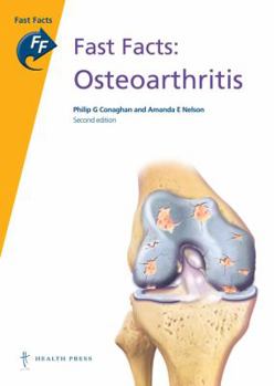 Paperback Fast Facts: Osteoarthritis Book