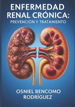Paperback Enfermedad Renal Crónica. Prevención Y Tratamiento [Spanish] Book